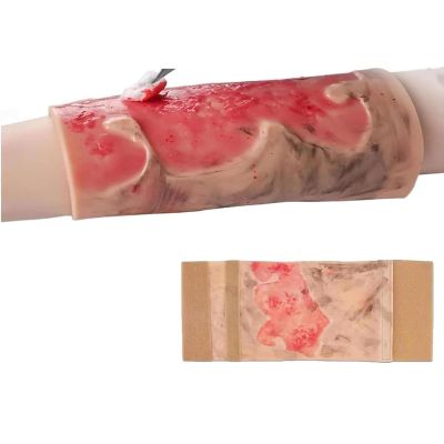 fnotlfue Simulated Burn Wound Model, 2-3 Degree Limb Burn Training Pad, Wearable & Reusable Burn Injury Simulation Model for Burn Care Practice, Medical Education and Teaching Demonstration