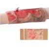 fnotlfue Simulated Burn Wound Model, 2-3 Degree Limb Burn Training Pad, Wearable & Reusable Burn Injury Simulation Model for Burn Care Practice, Medical Education and Teaching Demonstration view 1