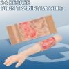 fnotlfue Simulated Burn Wound Model, 2-3 Degree Limb Burn Training Pad, Wearable & Reusable Burn Injury Simulation Model for Burn Care Practice, Medical Education and Teaching Demonstration view 3