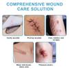 Silver Silicone Adhesive Foam Dressing Without Border 4 Pack Gentle Adhesive Waterproof Pads Ag Sterile Highly Absorbent Wound Dressing 4"4" for Burns Ulcers Abrasions Pressure Sore view 3