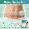 Lonqi 3-1 Care Patch,Lonqi Labs Patch,Silicone Scar Tape for All Skin Types,Wrinkles,ReusableC-Section, Burn, Surgical Scars (1PCS) view 4