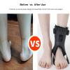 Vireon Sweet Biorine Foot Drop Brace, Lifty- Foot Drop AFO Brace, Lightweight Drop Foot Orthosis, Ankle Stabilizing And Walking Supportive, Adjustable, Fits Inside Shoes (Right, Large) view 3