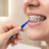 100 Pcs Interdental Brushes, Between-Teeth Braces Brush for Teeth, Interproximal Dental Brush Picks, Toothpick Dental Flossing, Oral Hygiene Cleaning for Home, Travel, Work, School. view 4