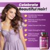 Biotin Hair Growth Capsules for Women & Men, 10,000mcg Biotin with Collagen, Saw Palmetto, MSM & Zinc, Hair, Skin & Nails Support, Daily Nutritional Capsules (60 Count) view 2