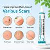 Wankangfan Scar Gel,4 Pack For Hypertrophic Scars From Surgery, Burns & Injuries, Helps Improve Scars & Prevent Scar Formation For Closed Wounds view 3