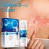 Pawmi Psoriasis Care Cream Vitamin B12 Cream Skin Itch and Redness Treatment view 2