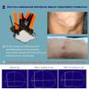 Pectus Carinatum Orthosis Brace, Pigeon Chest Support, Thoracic Depression Brace, Freely Adjust The Size, Anti-slip and Anti-displacement Design, Skin-Friendly and Breathable, Day and Night Use (XS) view 3