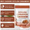 NVXNMSD Ceylon Cinnamon Softgels with MCT Oil, 300 Softgels Cinnamomum Verum Bark Extract Capsules True Ceylon Cinnamon Supplement, Supports Digestive & Overall Wellness Non-GMO Gluten-Free view 2