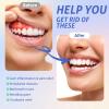 Red Light Therapy for Gums, Red & Blue LED Light Experience with 18 LEDs, Comfortable Silicone Mouthpiece, Portable Personal Oral Care for Gum Health Toothache Relief, Bleeding Gums view 2