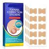 100PCS Ingrown Toenail Correction Stickers -Adhesive Foot Patches for Paronychia Treatment and Pedicure Care view 1