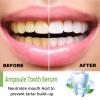 Ampoule Tooth Serum, 3V Fruit Acid Whitening Serum, 100% Plant Extract, Removes Dental Calculus, Freshens Breath, 1.5ml x 10 view 4