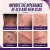 ABERA Kelo Scar Cream Scar Removal Cream for AKN Bump Treatment, Razor Bump Treatment for Men & Keloid Bump Removal with Purple Onion & Black Reishi view 2