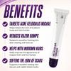 ABERA Kelo Scar Cream Scar Removal Cream for AKN Bump Treatment, Razor Bump Treatment for Men & Keloid Bump Removal with Purple Onion & Black Reishi view 3