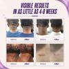 ABERA Kelo Scar Cream Scar Removal Cream for AKN Bump Treatment, Razor Bump Treatment for Men & Keloid Bump Removal with Purple Onion & Black Reishi view 4