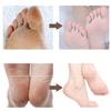 TEDILUVI Electric Foot Grinder for Removing Dead Skin and Calluses Artifact Heel Rechargeable Tool Household Automatic Pedicure view 3
