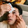 Eye Drop Guide Precise Comfortable Eyedropper Tool view 2