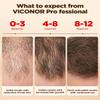 Hair Growth System: Red Light Therapy for Hair Growth Laser Cap - FDA Cleared Laser Therapy Device; Low Level Laser Therapy (LLLT) Device for Home Use, Hands-Free Portable Design view 4