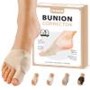 TPVEEN Bunion Corrector Relief Sleeve,Toe Socks for Hallux Valgus,Anti Slip Gel Cushion Pads,Big Toe Alignment Relief,Bunion Pain for Men & Women. (Small: Women(4.5-7), Beige) view 1