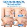 Silicone Scar Sheets Breast- Medical Grade Silicone Scar Sheets - 8 Pack view 2