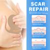 Silicone Scar Sheets Breast- Medical Grade Silicone Scar Sheets - 8 Pack view 3
