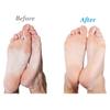 Emjoi Micro-Pedi Battery Operated Callus Remover view 4