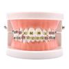 Angzhili 1 Piece Dental Demonstration Orthodontic Model with Metal Wires and Bracket (Metal Bracket) view 1