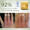 Ora's Amazing Herbal Touchy Skin Salve, Eczema Cream for Kids and Adults, Natural Sensitive Skin Treatment, Itch Cream, Calendula Ointment, Dry Skin Balm, Fragrance Free, 1 oz Travel Size view 2