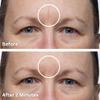 Dermaflage Scar Filler, Refill Applicator view 4
