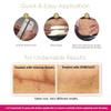 Embrace Active Scar Defense for New Scars, FDA-Cleared Silicone Scar Sheets, 2.4 Inch, Medium, 60 Day Supply (Recommended Treatment) view 4