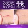 CICATRICURE Face & Body Scar Gel, Reduces The Appearance of Old & New Scars, Stretch Marks, Surgery, Injuries, Burns and Acne, 1 Ounce- Pack of 2 view 3
