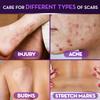 CICATRICURE Face & Body Scar Gel, Reduces The Appearance of Old & New Scars, Stretch Marks, Surgery, Injuries, Burns and Acne, 1 Ounce- Pack of 2 view 4