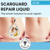 Scarguard Repair Liquid with Vitamin E 0.5 oz (Pack of 3) - Packaging may vary view 2