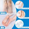 MADHOLLY 5 Pairs Silicone Heel Protectors- Breathable Heel Gel Heel Cushions for Cracked Heel- Heel Cups Heel Cover for Heel Repair Women Men view 2