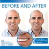 Instant Smile Temporary Tooth Kit -Pro-Series view 3