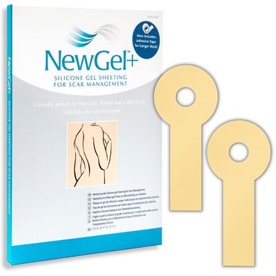 MyNewGel Advanced Silicone Professional Scar Sheets | Ultra-Thick, Lollypop-Shaped | Post Breast Surgery Cosmetic Procedure | 2.9" x 6.5" (2-Count) - Beige