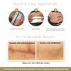 Embrace Active Scar Defense for New Scars, FDA-Cleared Medical-Grade Silicone Scar Sheets for Hypertrophic & Keloid Scar Treatment, 6.3 Inch, Extra-Large, 30-Day Supply view 4