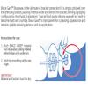 Orthodontic Silicone Wax For Braces ~ With Mirror view 2
