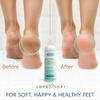 Callus Remover for Feet (Extra Strength) Foot Callus Remover Gel - Pedicure Tools for Feet Scrubber  Foot Care Spa Essentials, 6oz view 3