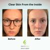 Clear Skin Acne Vitamin System | 20 Antioxidants, Botanicals & Minerals | 60 Count Pack of 4 view 2
