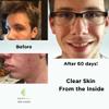 Clear Skin Acne Vitamin System | 20 Antioxidants, Botanicals & Minerals | 60 Count Pack of 4 view 3