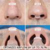 AIRMAX Nasal Dilator for Better Sleep - Natural, Comfortable, Anti Snoring Device, Snoring Solution for Maximum Airflow and Easier Breathing 2 Size Trial Pack (Small and Medium - Clear) view 4
