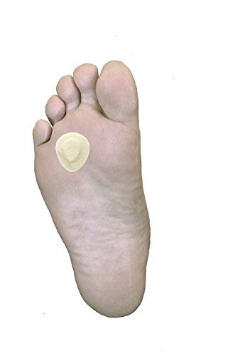 1/4" Skived (Beveled) Morton's Neuroma Pads, 100 Ball of Foot Felt Cushions