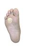 1/4" Skived (Beveled) Morton's Neuroma Pads, 100 Ball of Foot Felt Cushions view 1
