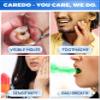 CAREDO Cavity Reversal Hydroxyapatite Toothpaste for Adults, Cavity Tooth Filler as Home Cavity Repair, Fluoride Free Reverse Cavities Treatment for Tooth Decay Repair, Remineralizing Repair 3.52OZ view 3