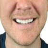 Instant Smile Comfort Fit Flex Natural Shade view 2