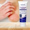 TriDerma Psoriasis Control Face & Body Cream - Maximum Strength 3% Salicylic Acid, AP4 Aloe Vera Gel, Urea Cream - Extra Moisturizing Treatment, No Cortisone or Coal Tar - FSA Eligible - 4.2 oz, 4Pack view 3