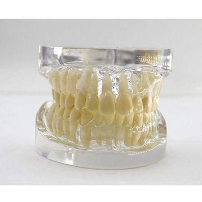 Model,Transparent Standard Model Implant Model for Teaching Adult,Transparent