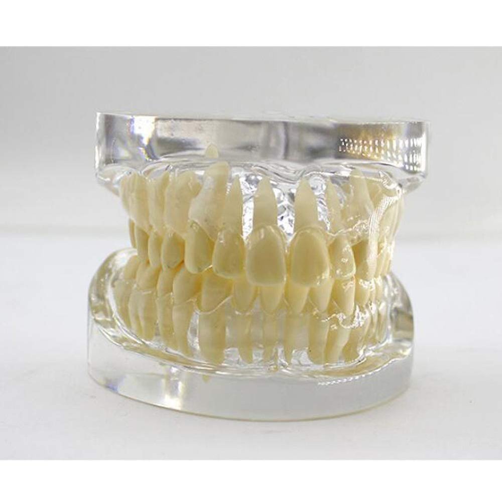 Model,Transparent Standard Model Implant Model for Teaching Adult,Transparent