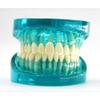 Model,Transparent Standard Model Implant Model for Teaching Adult,Transparent view 3