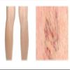 Vitella Vein VIT Benemedo - Spider, Varicose Veins - Developed with Dermatologists - 50ml view 2